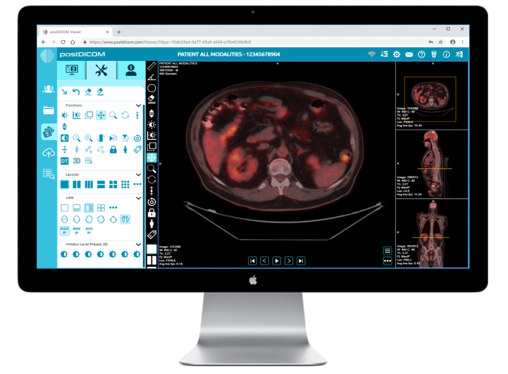 DICOM viewer for Mac free