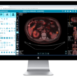 DICOM viewer for Mac free