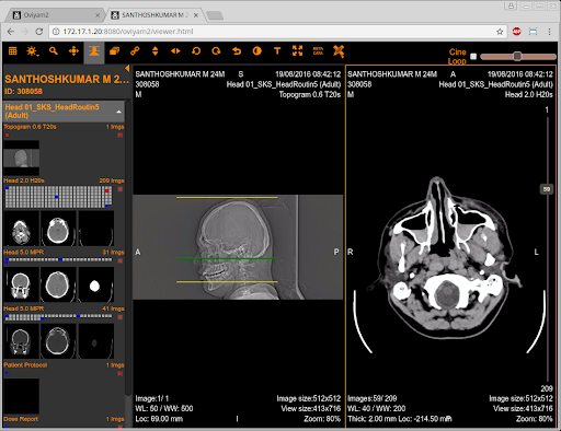 mobile DICOM viewer